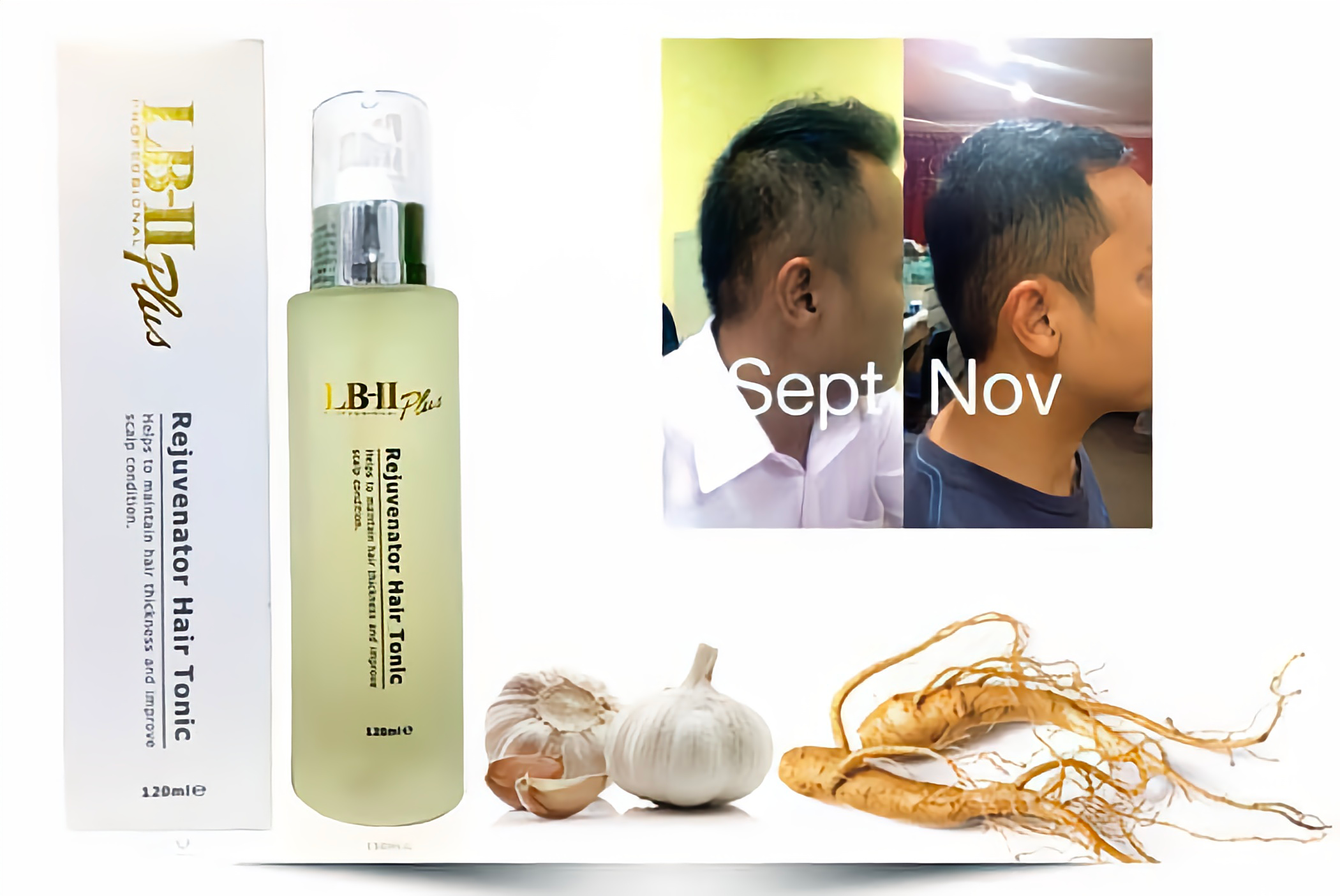 LB-II Rejuvenator Hair Tonic Perangsang Pertumbuhan Rambut dari Akar, Kuat & Sihat!