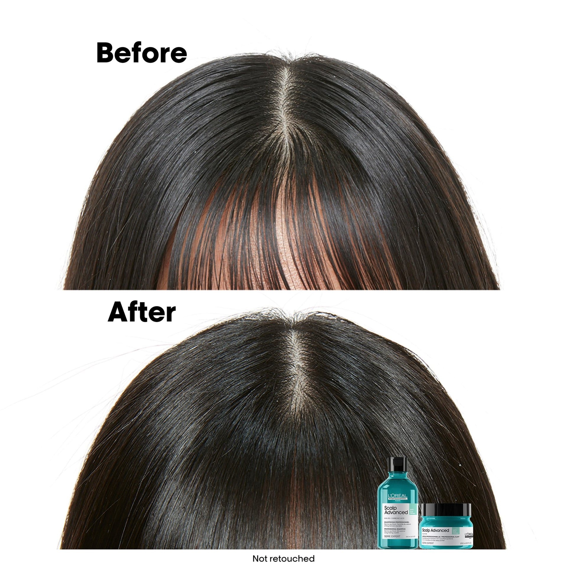 Loreal Professional Scalp Advanced Anti Oiliness Shampoo - Image 3